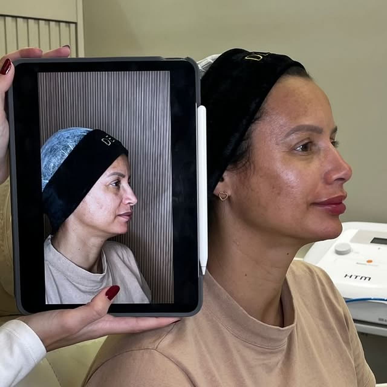 Sala de atendimento da Top Center com aparelho de estética e a profissional mostrando à paciente a foto de antes no tablet.